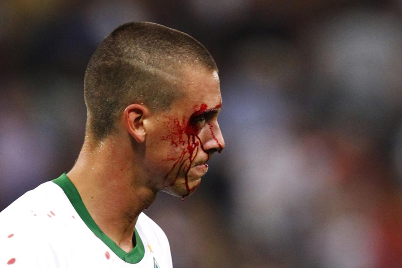 \'Werder Bremen\'s Sandro Wagner walks off injured during the match against Sampdoria in their Champions League playoff second leg soccer match at Luigi Ferraris stadium in Genoa, August 24, 2010.    