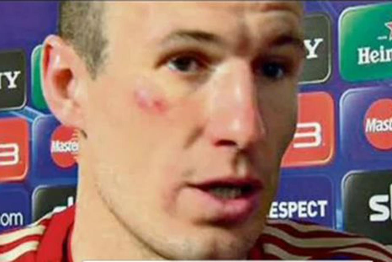 Robben