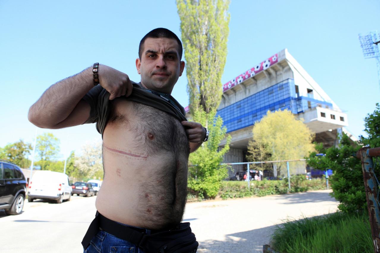 '10.04.2011. Maksimir, Zagreb- Mario Galic, navijac Dinama kojeg je policajac ranio iz pistolja na derbiju 1. svibnja prosle godine. Photo: Boris Scitar/PIXSELL'