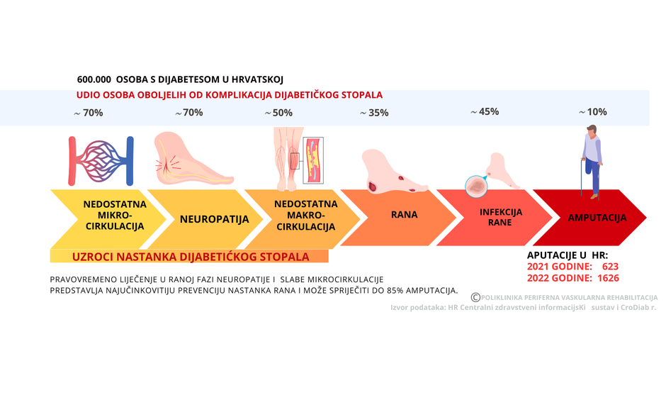 Poliklinika za perifernu vaskularnu rehabilitaciju