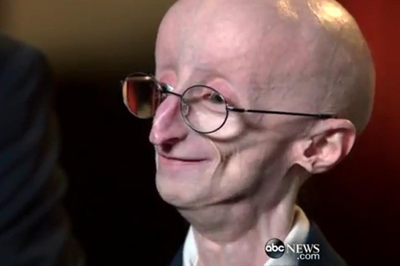 Sam Berns