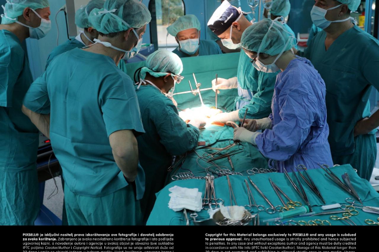 '30.10.2012., Zagreb - Britanski kirurg Aroori Somaiah izveo operaciju gusterace u KB Dubrava. Photo: Igor Kralj/PIXSELL'