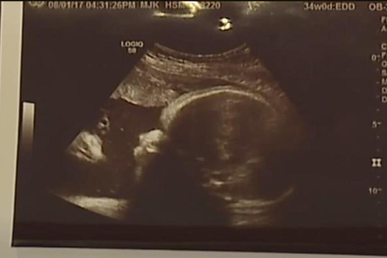 Slika ultrazvuka