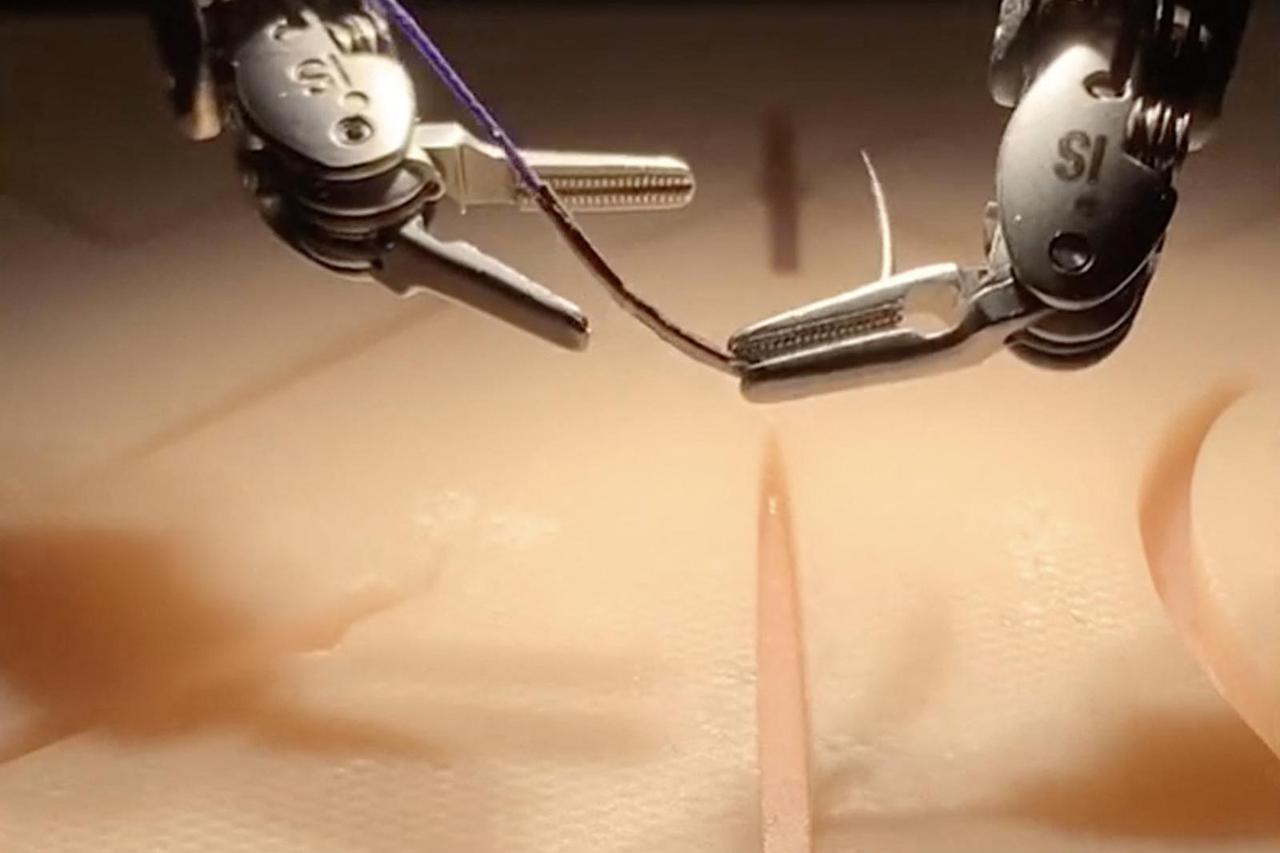 Un robot capable de faire des points de suture en chirurgie