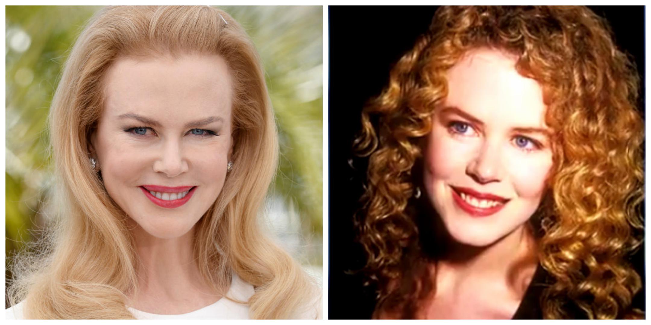 Nicole Kidman priznala je da je koristila botoks koji joj je zaledio i deformirao lice. Ova 44-godišnja glumica prije godinu dana priznala je kako više ne ide na tretmane botoksom jer sama sebi izgleda zastrašujuće od njih.