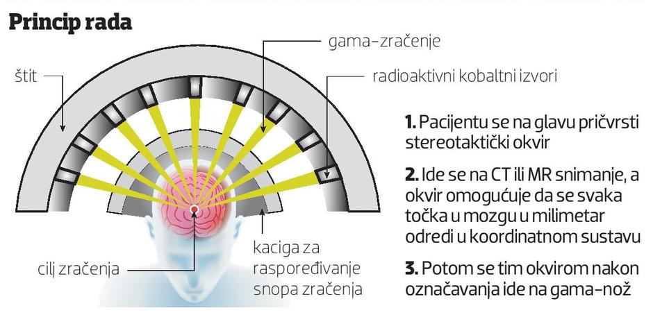 Gama-nož